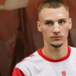 Tim Lemperle mit Pflaster auf der Nase