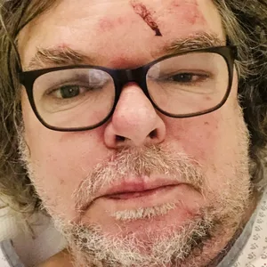 Der Geschädigte erlitt mehrere Hämatome im Gesicht.