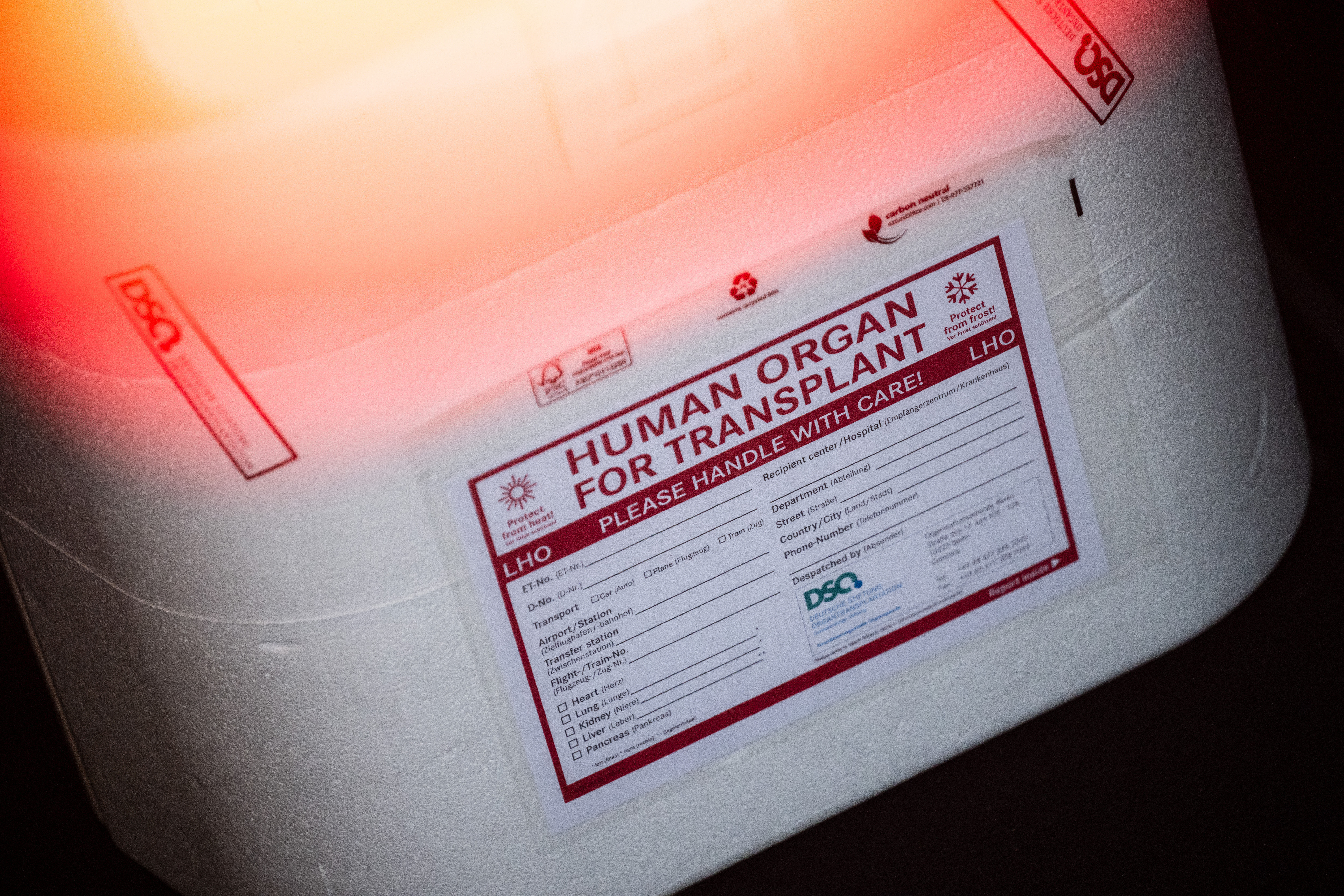 Die Zahlen zu Organspenden in Hamburg schwanken.
