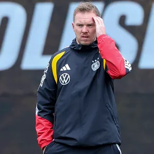 Julian Nagelsmann fässt sich auf dem Trainingsplatz an den Kopf