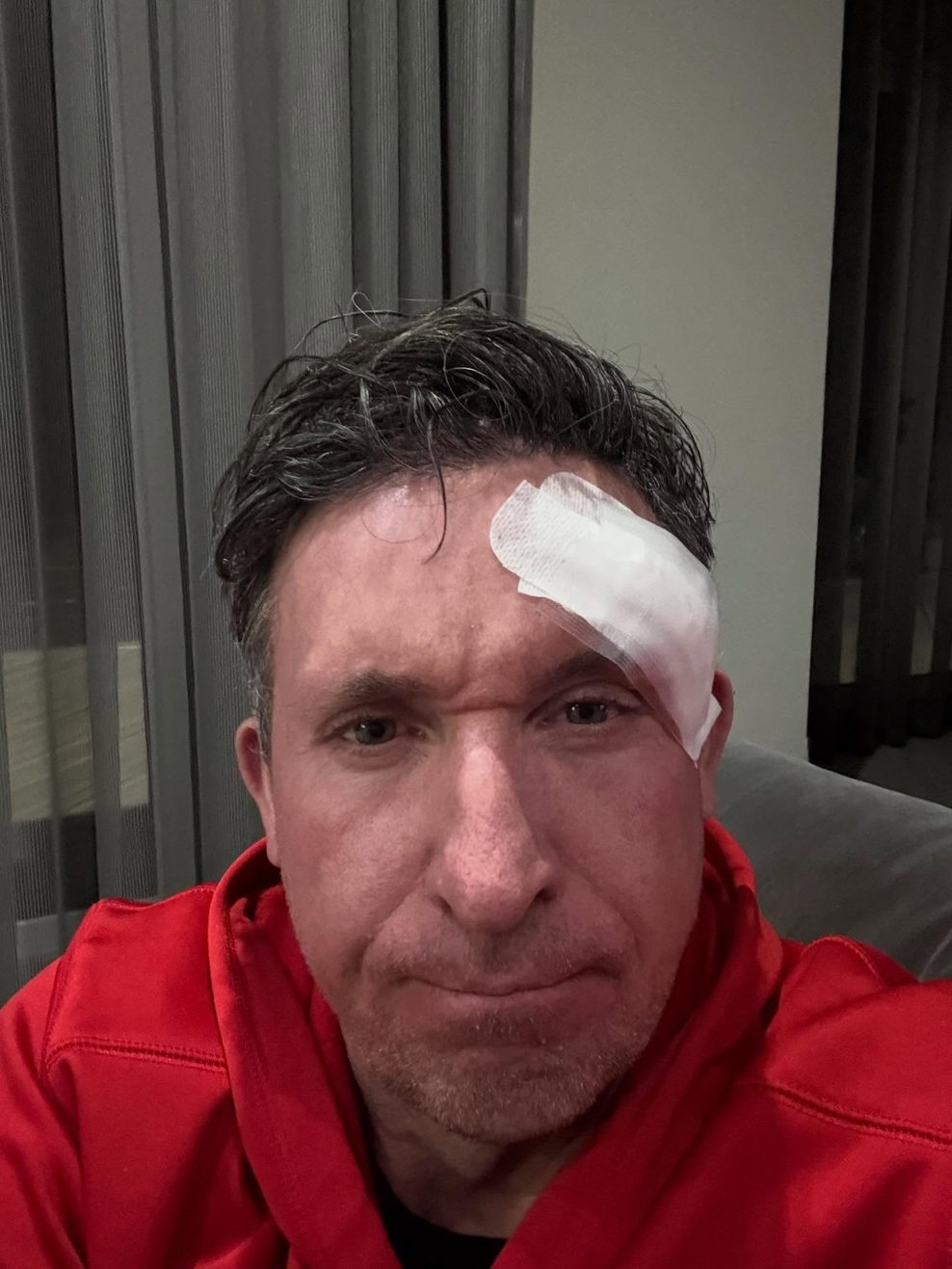 Ehemaliger Livepool-Spieler Robbie Fowler mit Verband über dem Auge