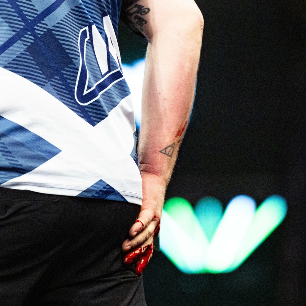 Die Hand von Cameron Menzies war nach seinem Ausraster blutüberströmt.