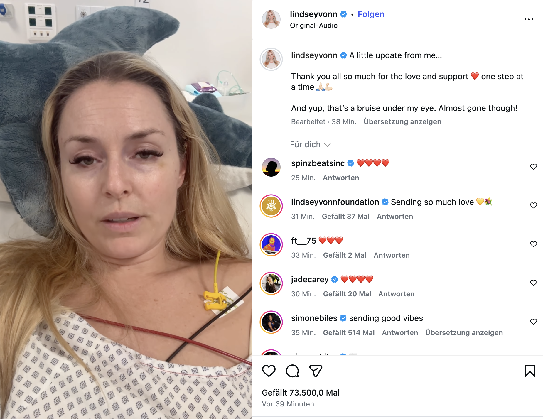 Lindsey Vonn liegt im Krankenhaus