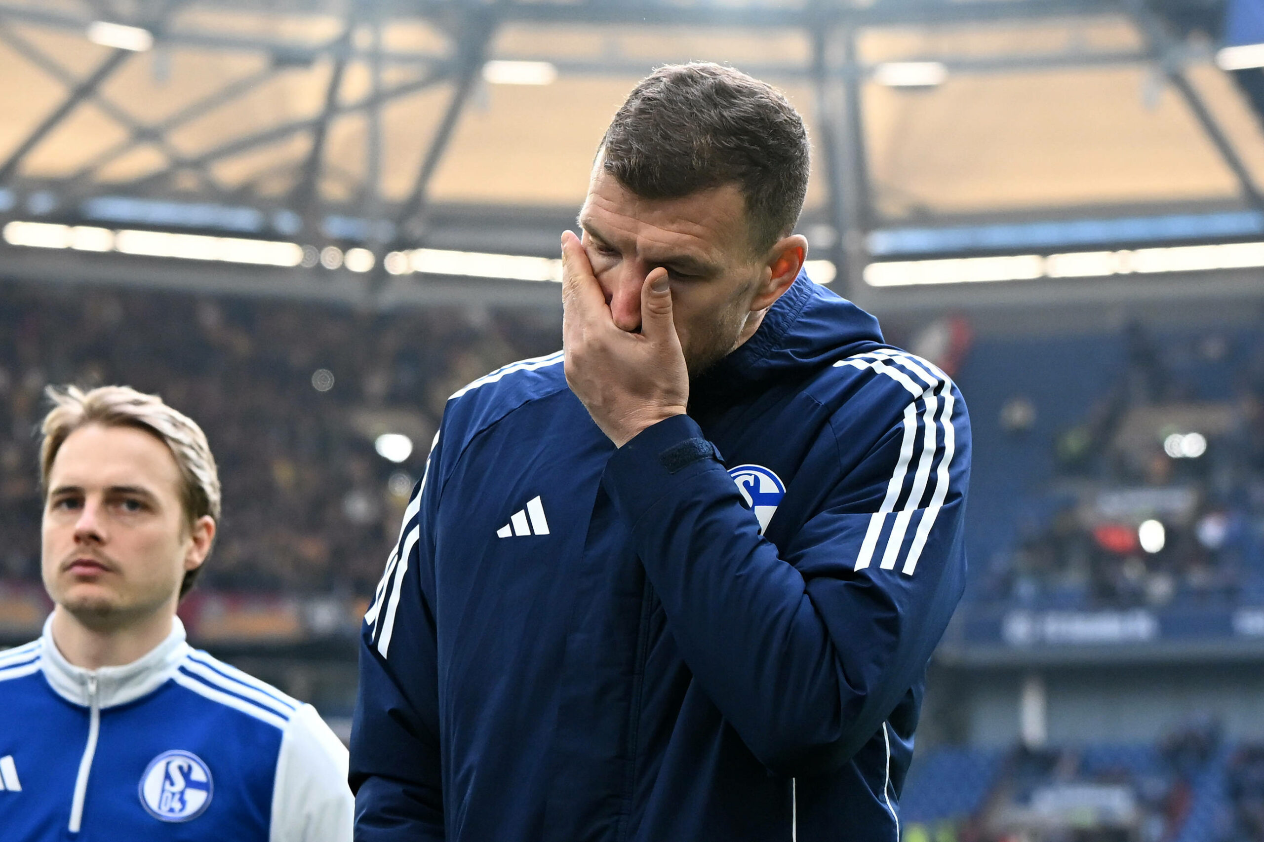 Edin Dzeko ärgert sich mit der Hand in seinem Gesicht