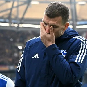 Edin Dzeko ärgert sich mit der Hand in seinem Gesicht