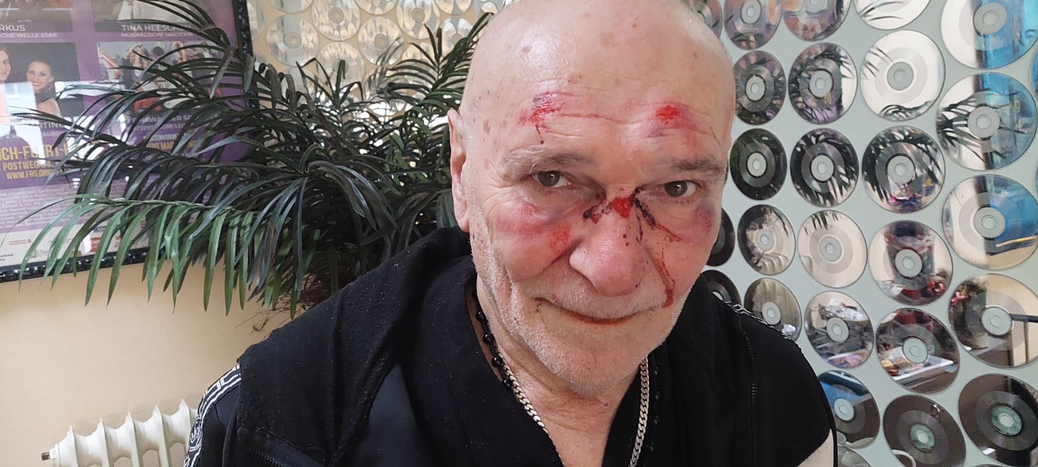 Sichtlich gezeichnet vom Überfall in seinem Büro: Schlagersänger Peter Sebastian.