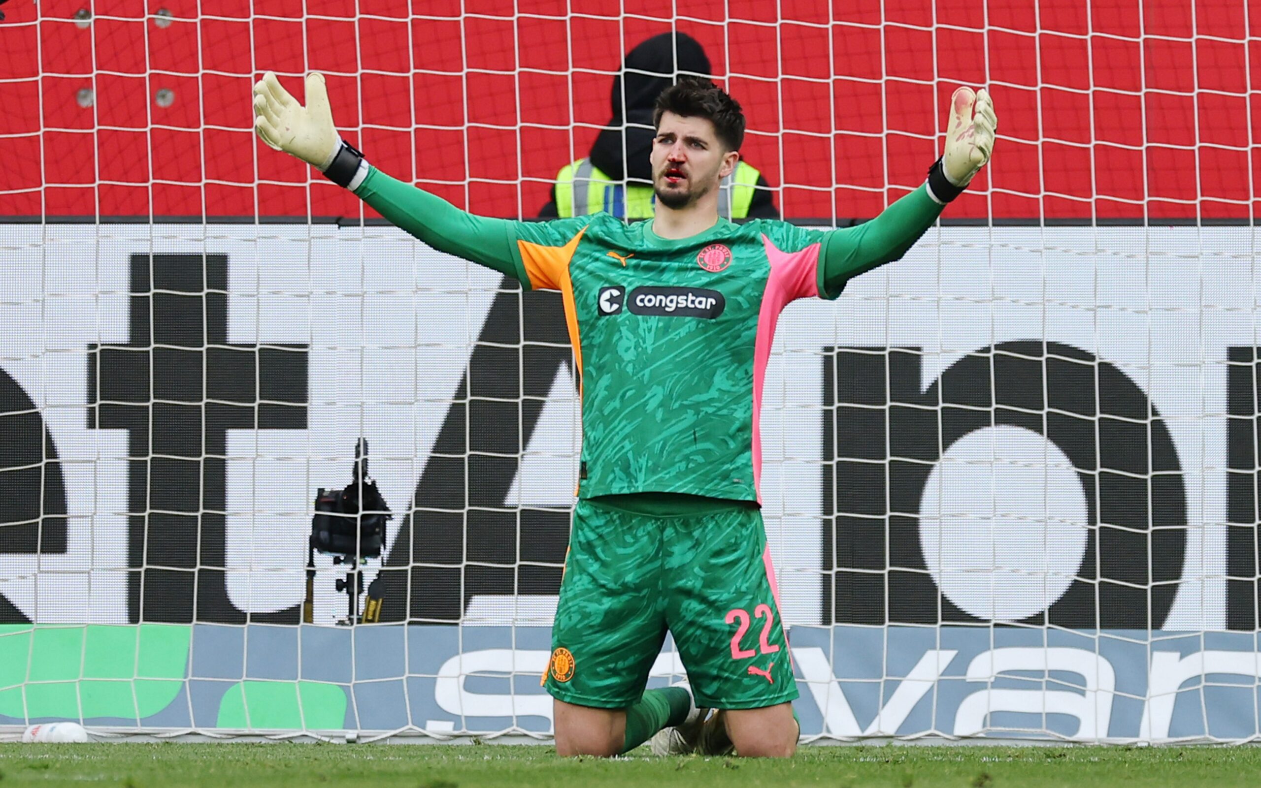 Nikola Vasilj mit blutiger Nase