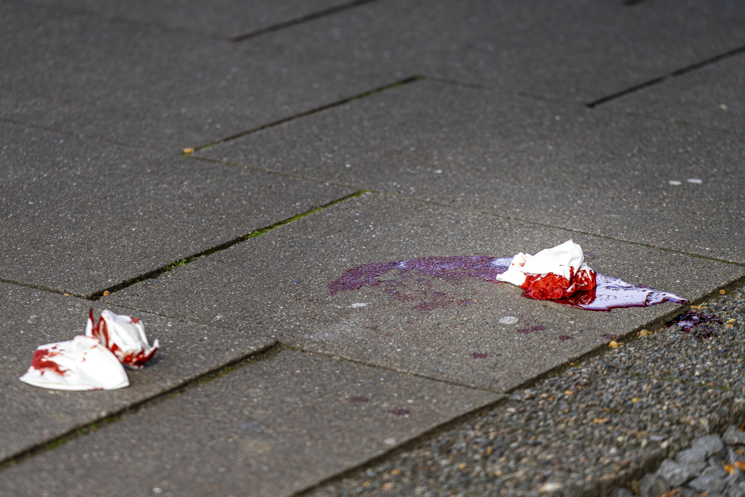 Blut auf einer Straße zusammen mit Taschentüchtern voller Blut (Symbolbild).