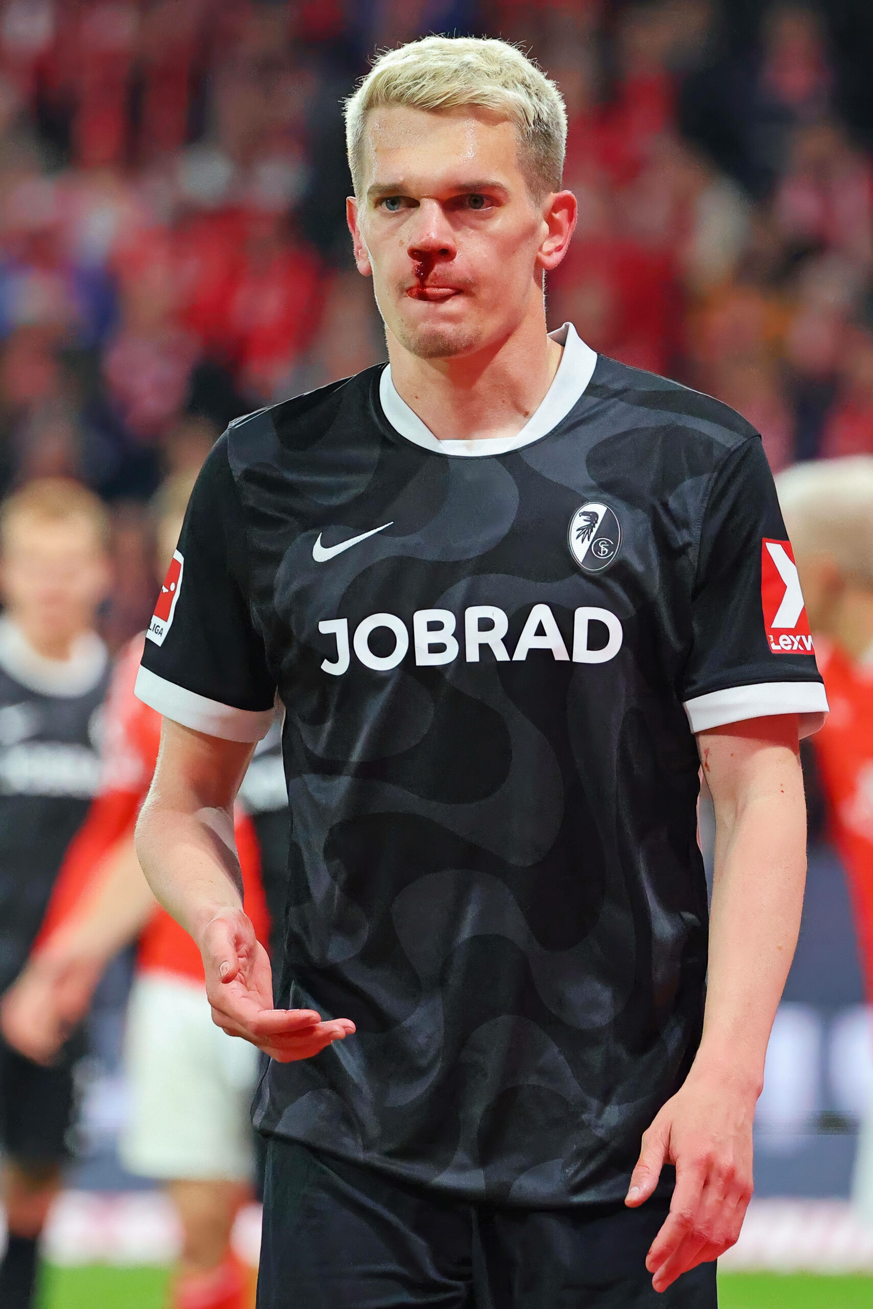 Mathias Ginter mit blutender Nase