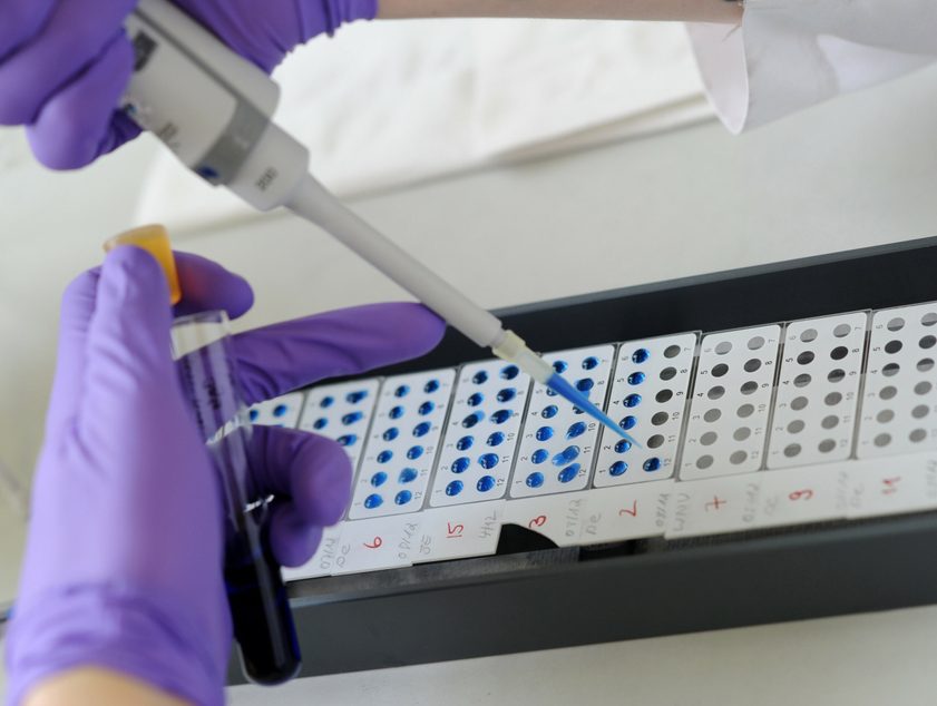 Eine medizinische Assistenzkraft untersucht im Labor eine Antigen-Antikörper-Reaktion.
